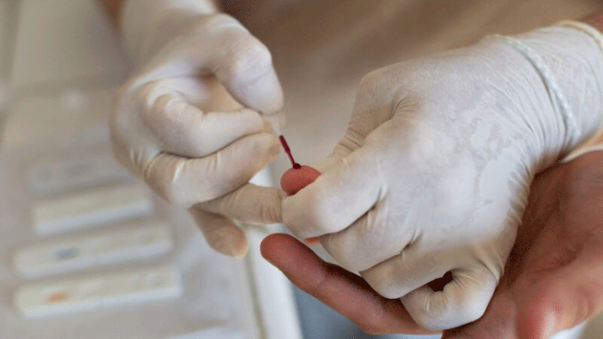 Santa Fé do Sul tem 210 pessoas infectados por HIV em tratamento