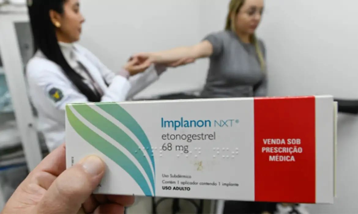 Governo inclui implante Implanon no SUS; 500 mil unidades chegam ainda em 2025
