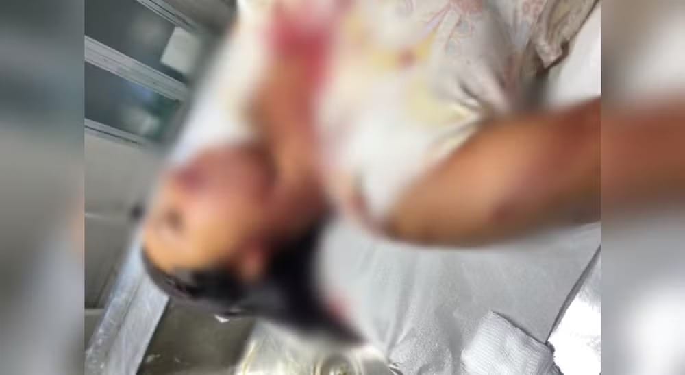 Mulher é agredida com barra de ferro pelo ex-namorado em Pontalinda