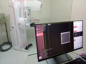 Prefeitura de Santa Fé do Sul entrega Mamógrafo Digital para Santa Casa da cidade