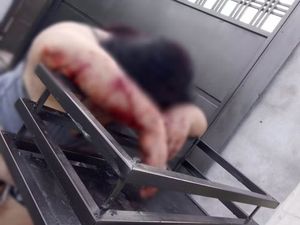 Ataque de cães da raça pit bull deixa mulher gravemente ferida em Estrela d'Oeste