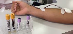 VÍDEO: Hemocentro de Fernandópolis faz apelo por doações de sangue e cadastro de medula óssea