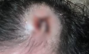 Briga termina com personal trainer desmaiado após ser atingido por peso de academia