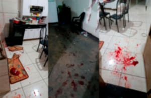 Mulher sofre tentativa de feminicídio em Jales e relata medo após ataque do ex-companheiro