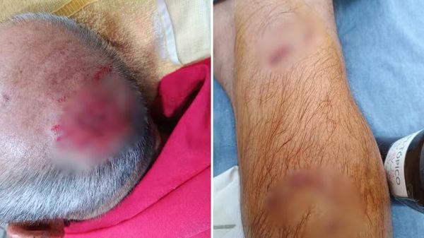 Cães atacam idosos em diferentes locais no mesmo dia, em Paranapuã